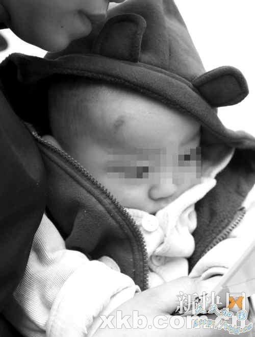 死里逃生的小孩子事发时受到惊吓。