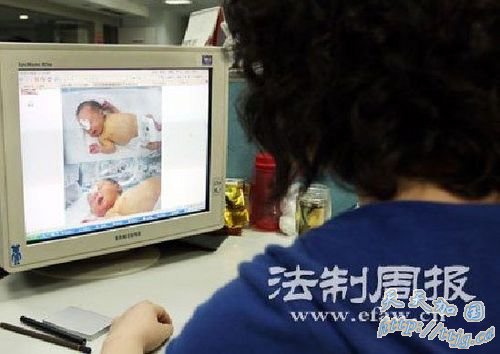 6网友将小春晓的照片发到网上呼吁更多人的帮助。