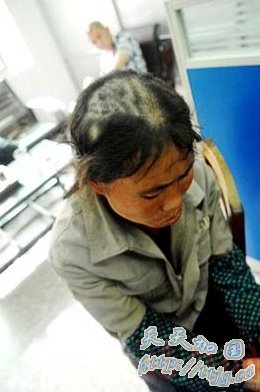 ȪʰŮ“”ۼ ͷ(ͼ)