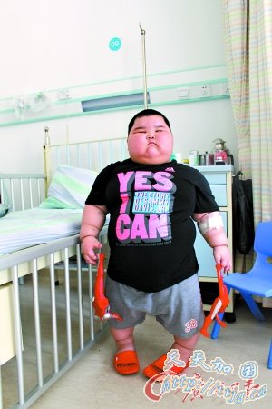 3岁男童体重达120斤体检一切正常(组图)