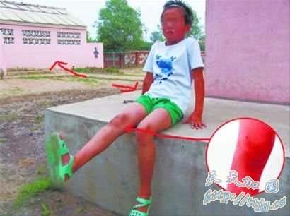 9ŮѧУ꼶ŮŰ1(ͼ)