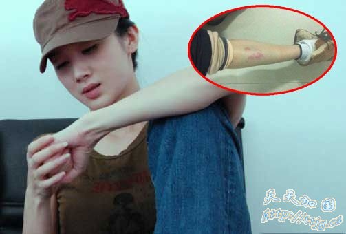 孙菲菲(资料图)