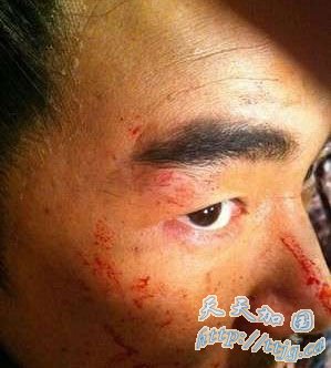 任贤齐拍《杨门女将》受伤。