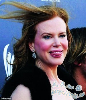 妮可·基德曼被疑再打肉毒杆菌 面部表情僵硬